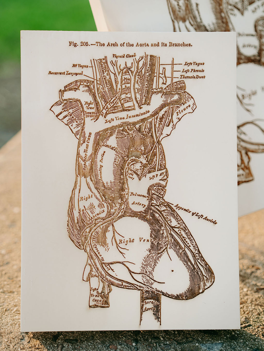Heart Diagram Laser Etched In Wood