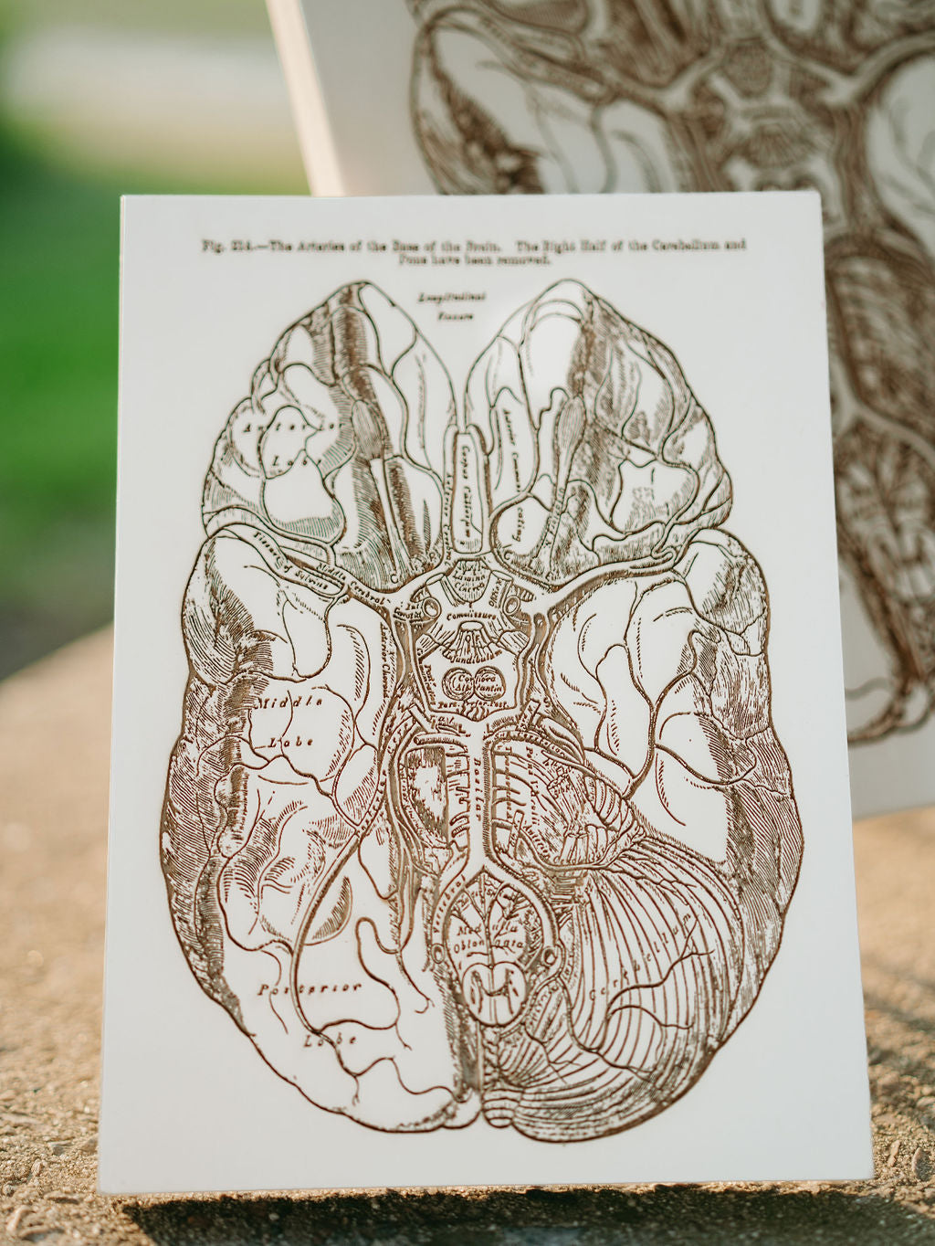 Gray's Anatomy - Brain
