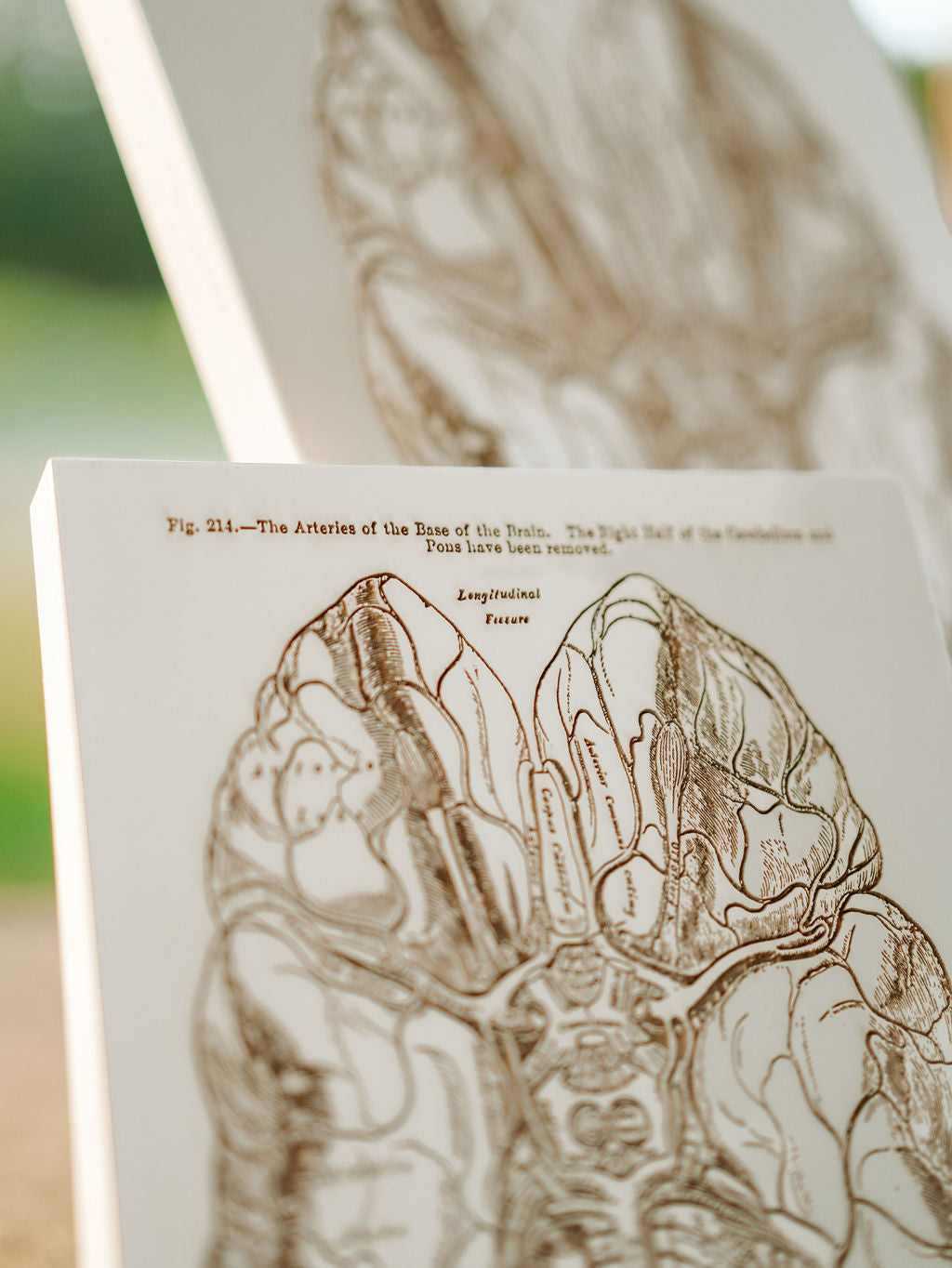 Gray's Anatomy - Brain