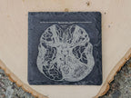 Medical Anatomy Art Coasters | 6pc Slate Set