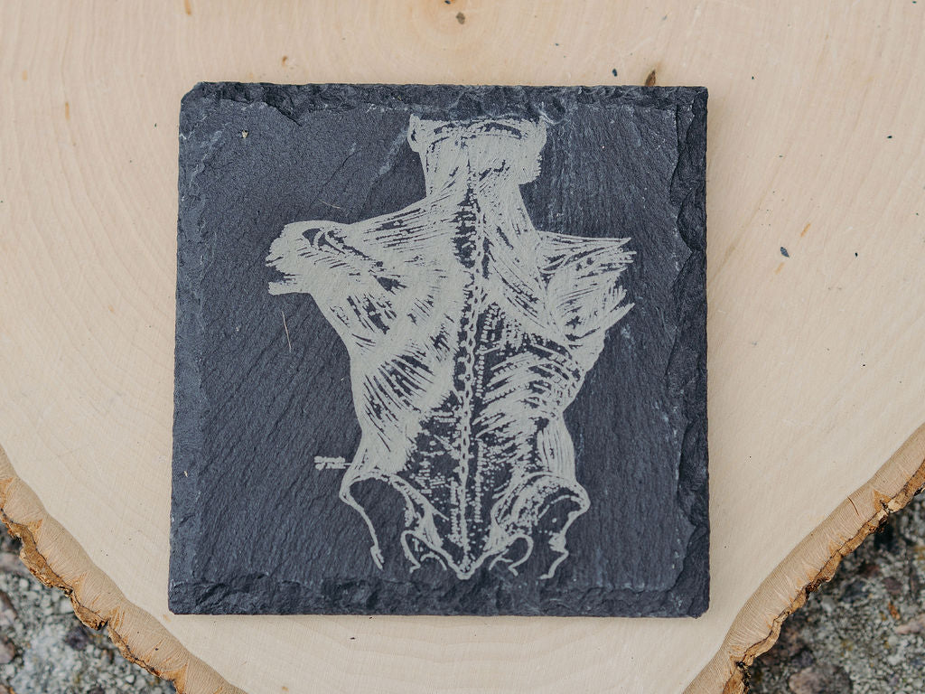 Medical Anatomy Art Coasters | 6pc Slate Set